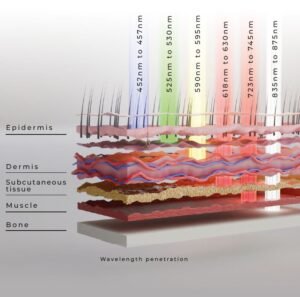 Infraraudonųjų spindulių terapija